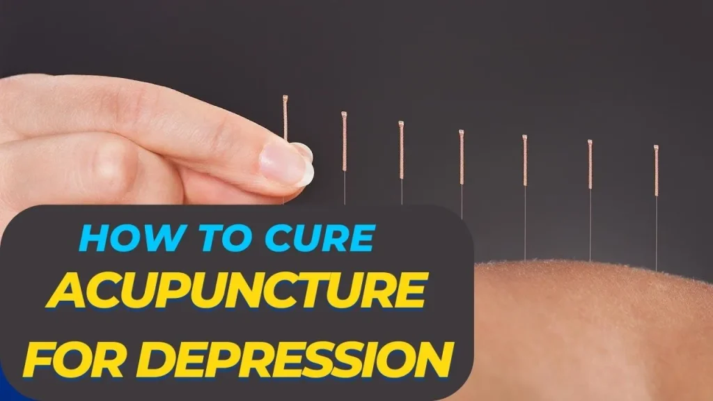 benefit of Acupuncture points for depression