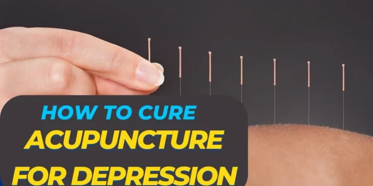 benefit of Acupuncture points for depression
