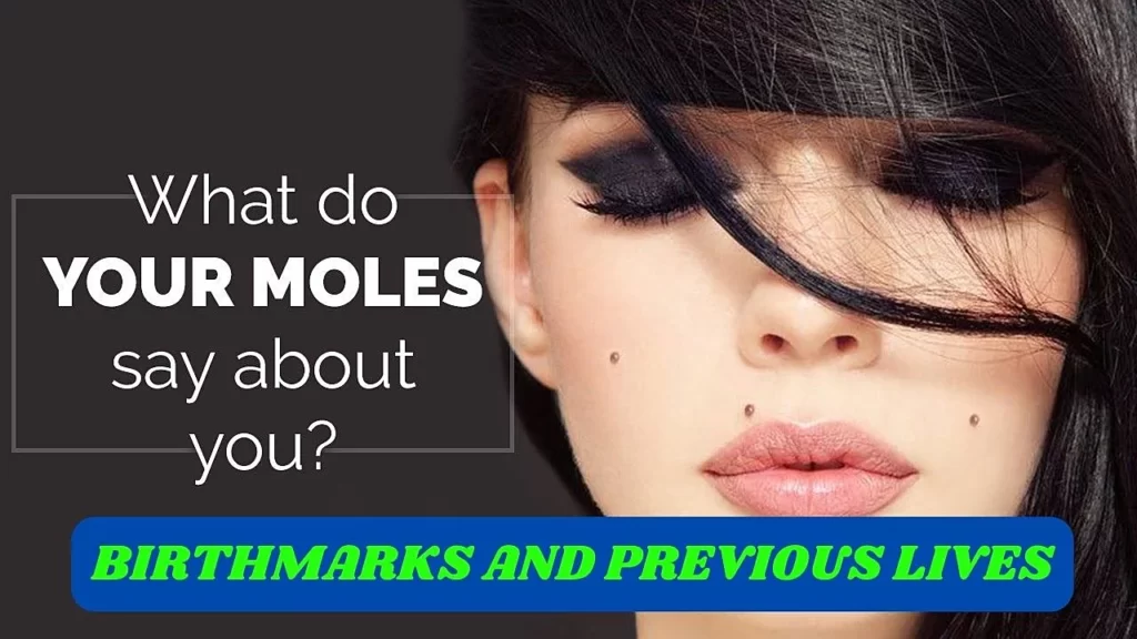 Psychic Birthmarks and their meaning