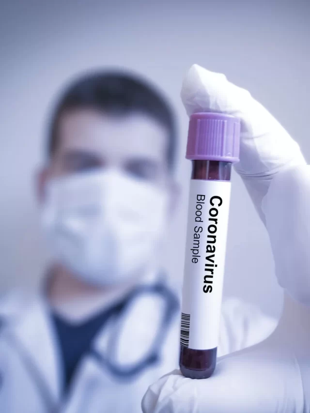Free Covid-19 tests_1